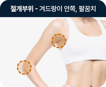 바디 지방흡입 절개부위 겨드랑이 안쪽 팔꿈치