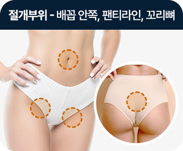 바디 지방흡입 절개부위 배꼽안쪽 팬티라인 꼬리뼈