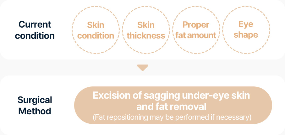 하안검 증상 피부상태 피부두께 지방적정량 눈모양 상태 확인 눈 밑 늘어진 피부절제 지방제거 필요시 지방재배치