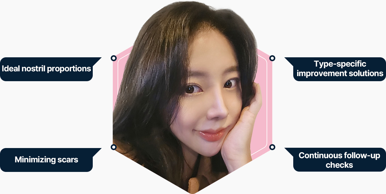 이상적인 콧볼비율 유형별 개선 흉터최소 지속적인 경과체크