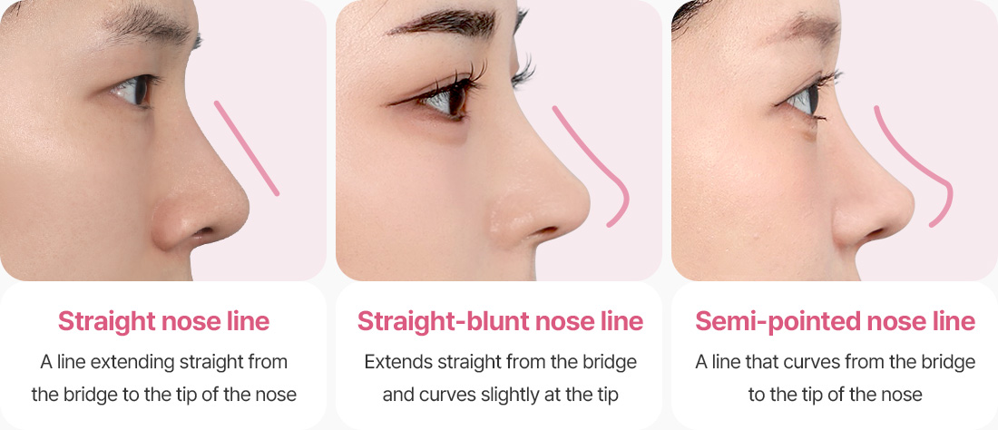 직선코라인 직반코라인 반버선코라인