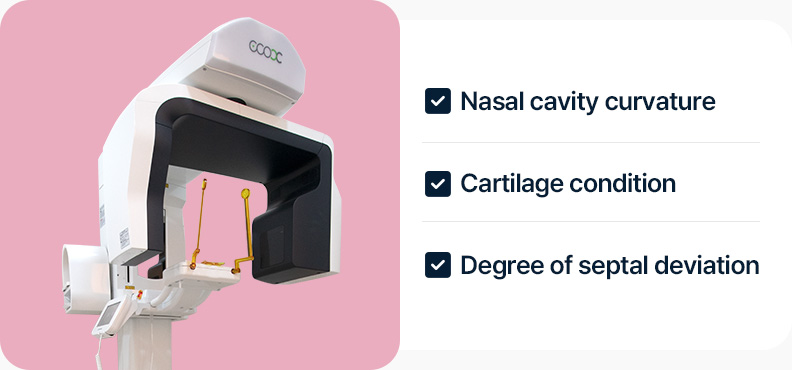3D CT 비강의 곡률 연골상태 비중격 비틀림