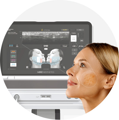 울쎄라 울쎄라피 프라임 울쎄라프라임 실시간 초음파 타켓팅 시술 리프팅