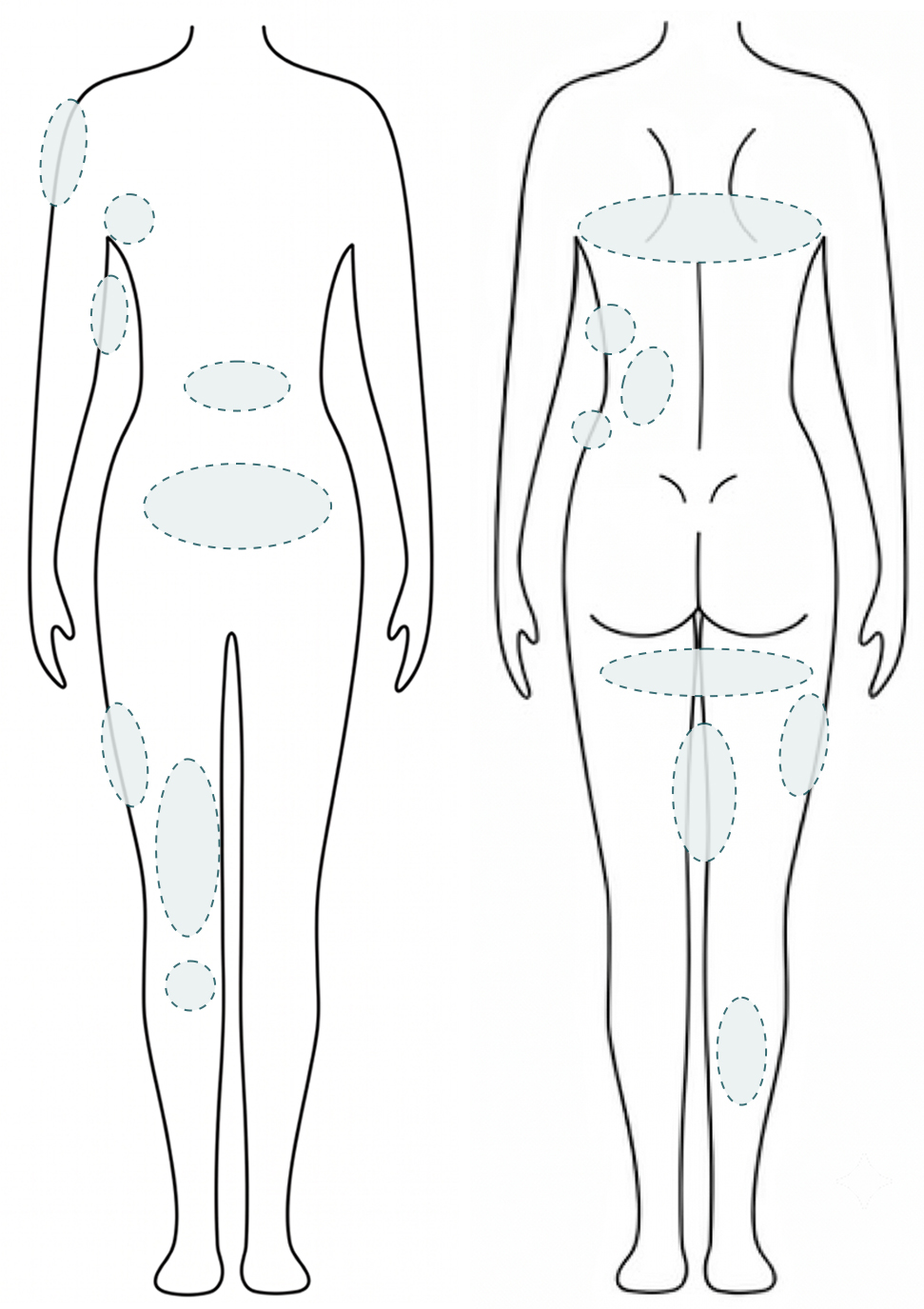 WonderFit injection body treatment areas