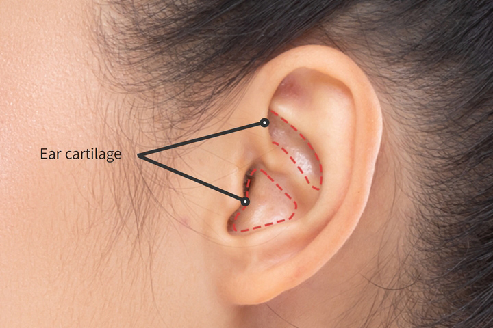 wonderful plastic surgery hospital in korea wonderful nose rhinoplasty autologous cartilage ear cartilage