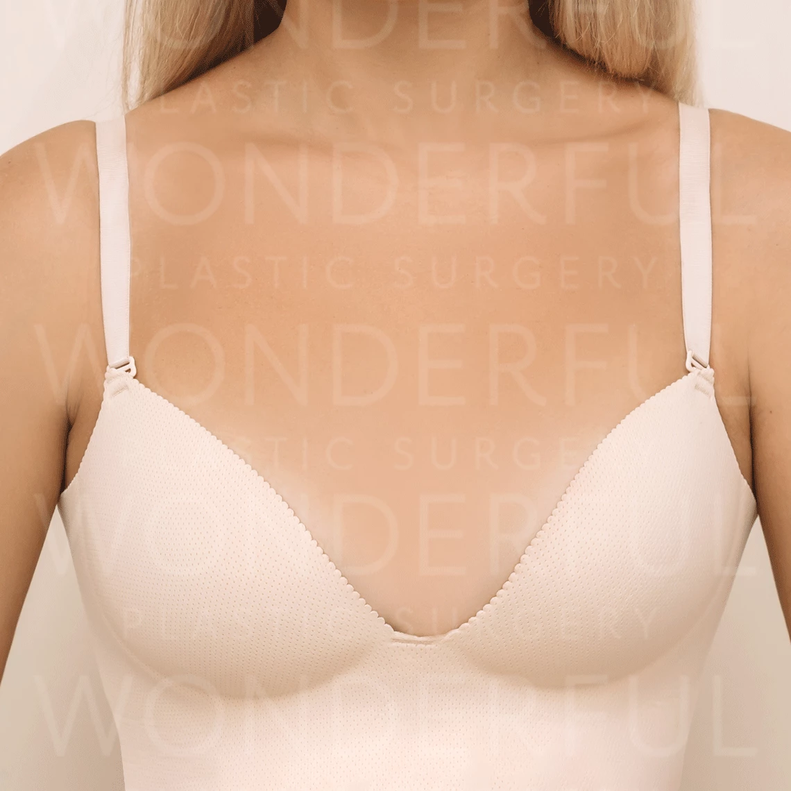 wonderful-plastic-surgery-hospital-korea-breast-augmentation-before-after-results-bfore-2