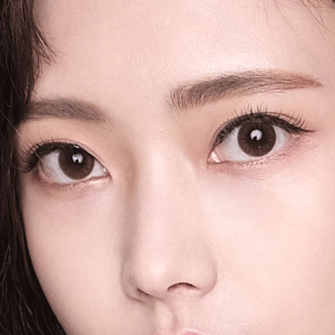 wonderful-plastic-surgery-in-korea-double-eyelid-surgery-seoul